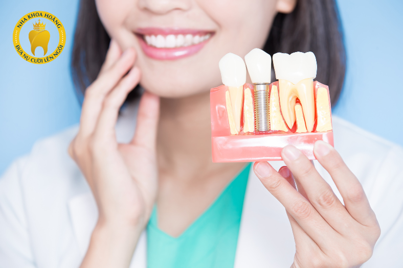 Các lợi ích của việc cắm răng Implant?