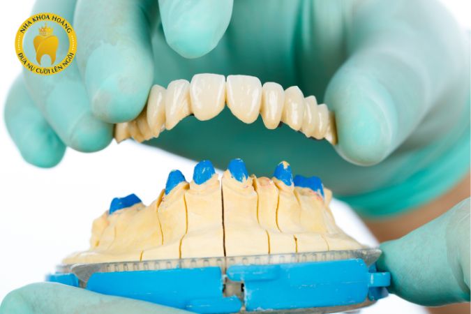 Khi nào nên cân nhắc dịch vụ bọc răng sứ?