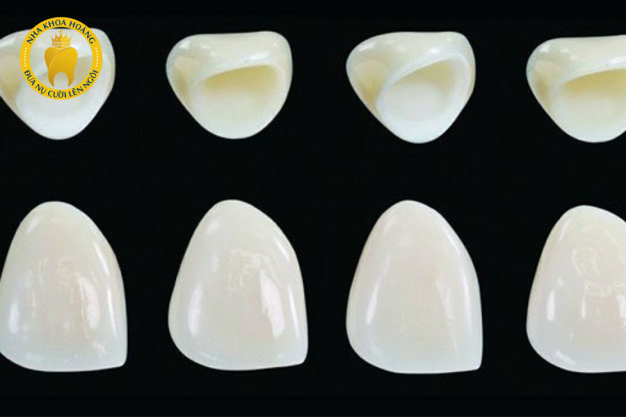 Răng sứ có hai loại chính là răng sứ kim loại và răng toàn sứ