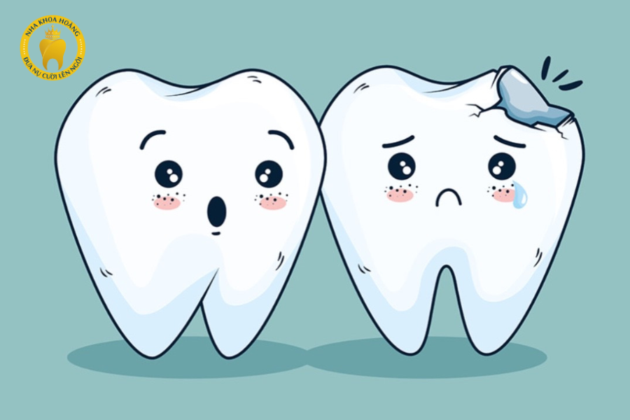Răng Bị Mẻ: Bọc Răng Sứ Hay Trám Răng?