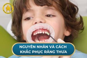 Nguyên nhân và cách khắc phục răng thưa.